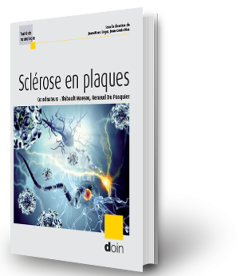 Image sur Sclérose en plaques